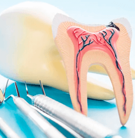 Tooth Saver: What's an Endodontist?