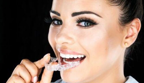 What is Invisalign Staten Island