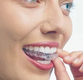 Invisalign - Invisible braces