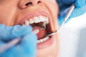 tooth sensitivity treatment