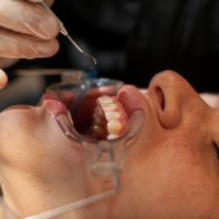 008. cosmetic dentistry services