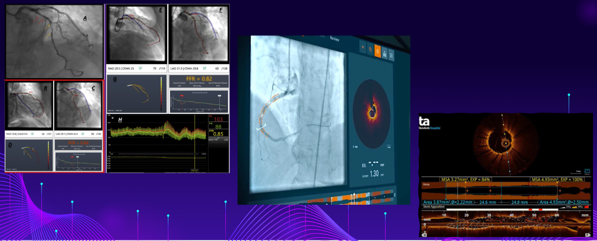 AI Trong Chẩn Đoán Y Khoa (Dự án Raywatt)