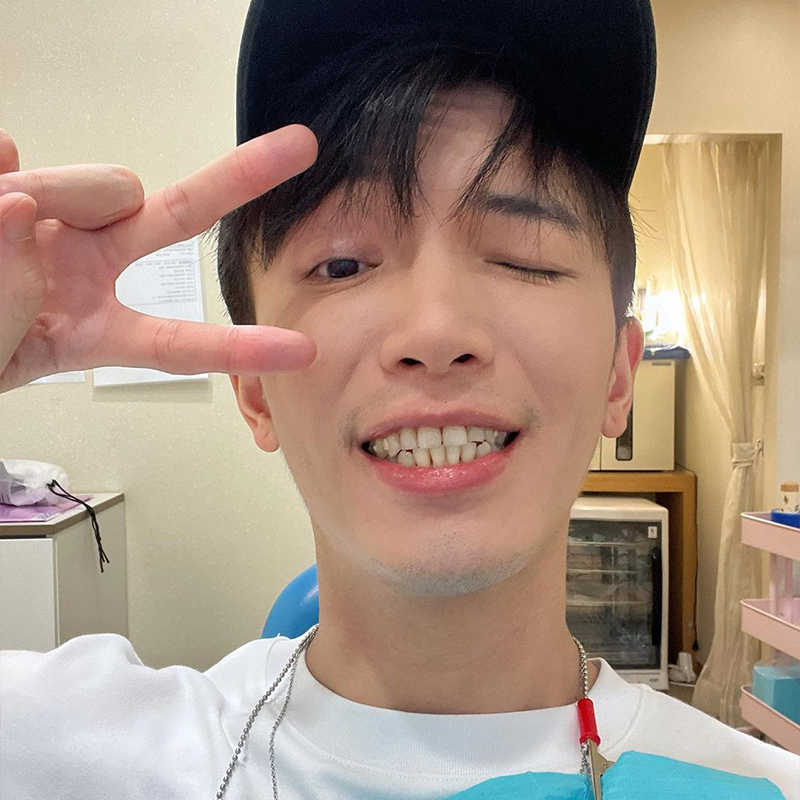 [SOV x 張睿Ray] 現在正式進入牙齒矯正的過渡期，但重點是！我之後會變很漂亮這就夠了～～