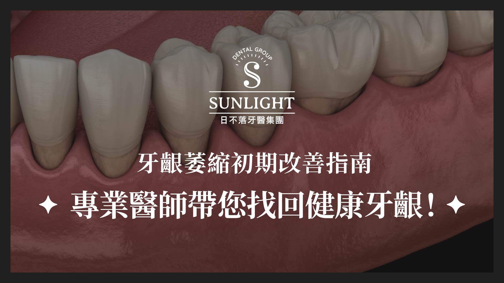 牙齦萎縮初期改善指南|專業醫師帶您在牙齦萎縮初期找回健康牙齦