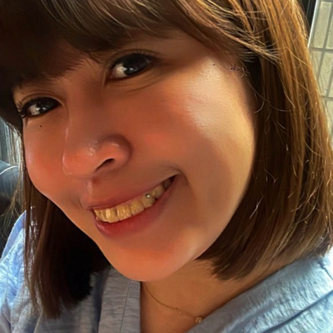 [SOV x 美奈子的。微日本旅行] 謝謝自己當初花錢花時間決定矯正的自己。已經矯正一年又5個月了，現在願意露牙齒微笑，覺得露齒笑真的很美！