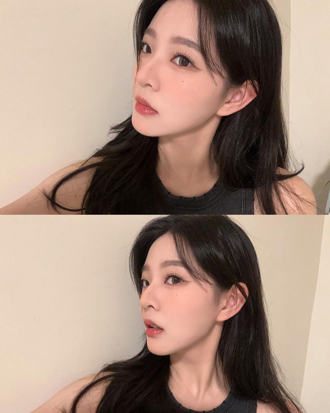 [SOV x 林嫺] 很高興我的牙套終於接近倒數啦！然後可以做貼片了🥹💓 ，牙齒排的越整齊也就不用磨太多，真是太棒了！！！