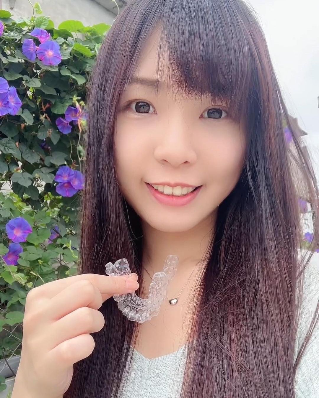 [SOV x 安安小日常] 終於拆掉骨釘啦～自由的感覺真是太感動了！SOV隱形矯正的後半段最感謝的就是李爵安醫師，他真的是我遇過最有耐心的醫師！