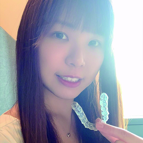 [SOV x 安安小日常]配戴SOV隱形牙套完成我的人生清單！