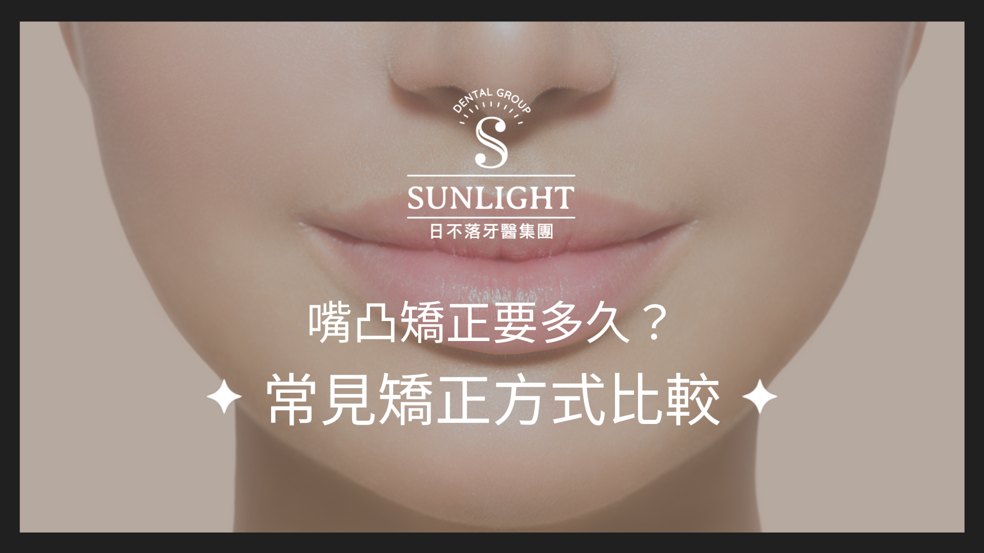 嘴凸矯正要多久?常見矯正方式比較