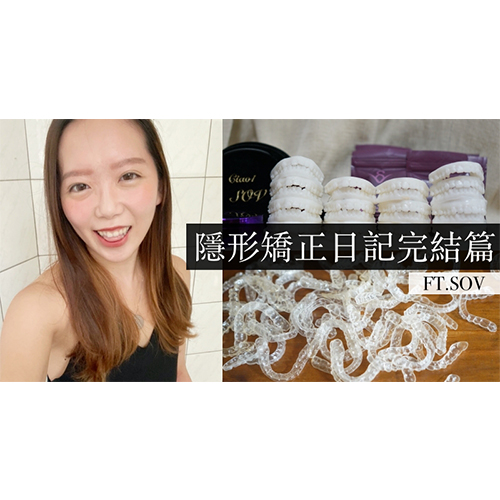 [SOV x 嗯嗯。莉莉嗯] 隱形矯正日記最終回｜18個月透明牙套畢業！牙齒矯正前後比較/維持器注意事項/真實心得