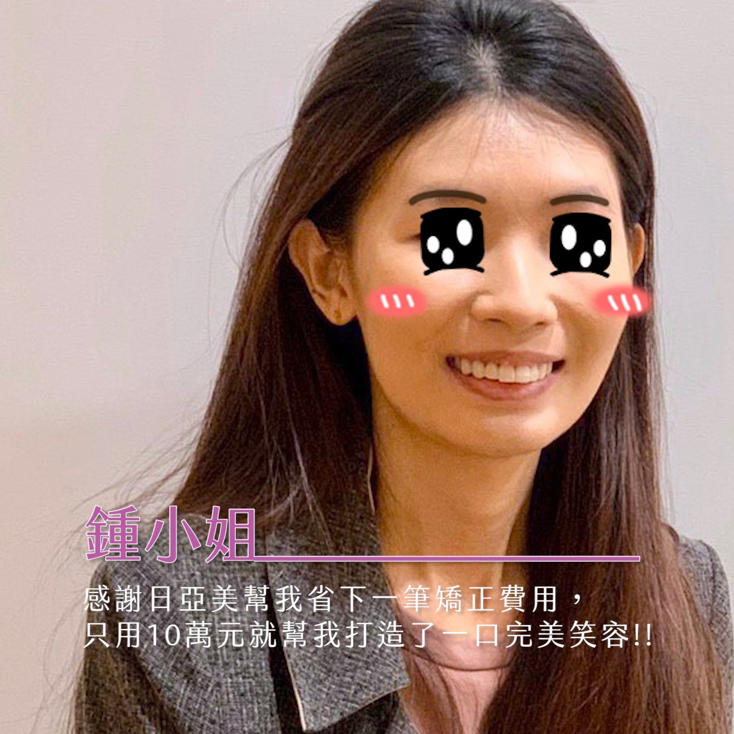 [職人瓷貼片]  我的齒色不均、牙齒不整用瓷牙貼片省下美白與矯正費用，輕鬆打造完美笑容！
