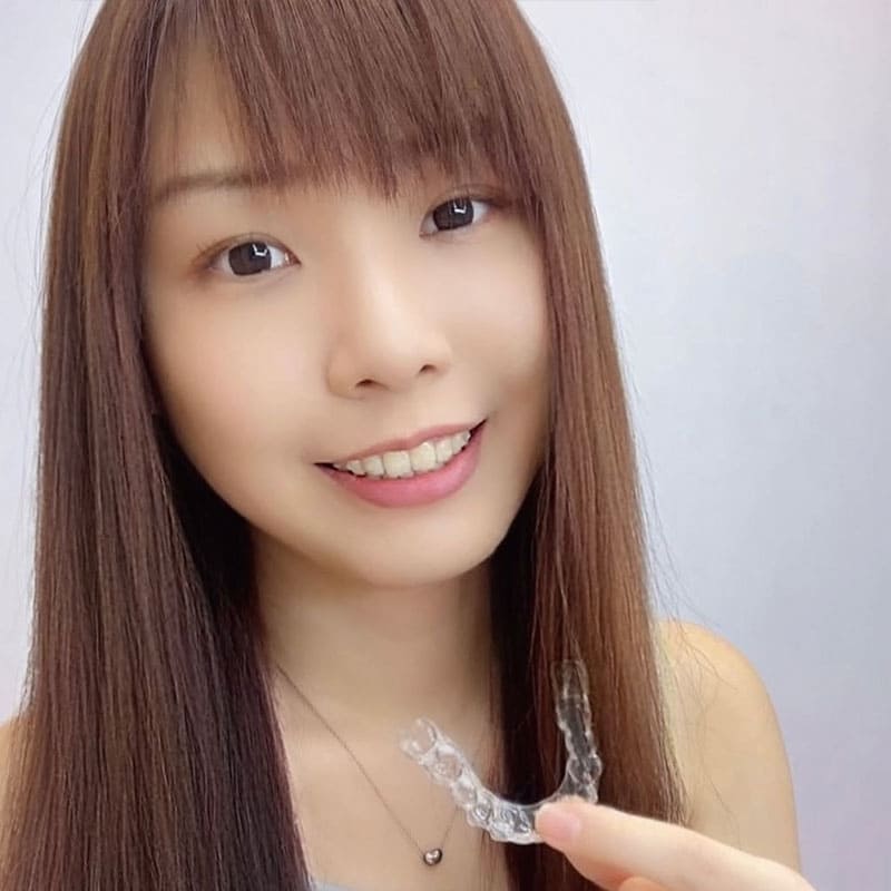 [SOV x 安安小日常] 以前舌頭都可以感受到 牙齒往外飛的弧度 現在變成偏垂直的角度 真的是太感動了🥹 從小到大的心願 又完成了一項! 快樂的從牙套人生畢業囉!