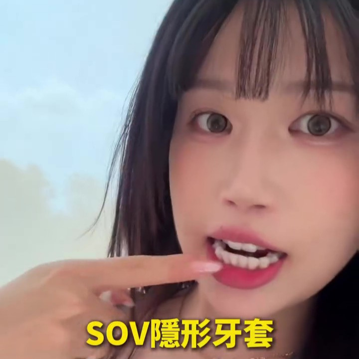 [SOV x 安知恩] 戴SOV隱形牙套兩年了！我的變美真實心得分享
