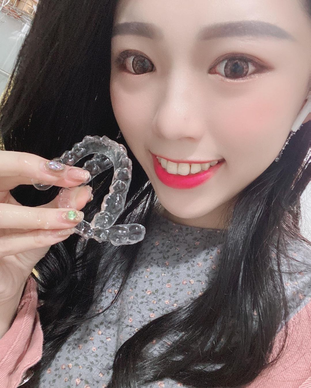[專科xShirley 芝榕] 每天看著牙齒在一點一點的變整齊☺️就有無比的幸福跟成就