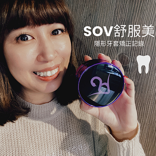 [SOV x 美奈子的。微日本旅行]終於開始牙齒矯正！諮詢/診所/價格/品牌懶人包分享！