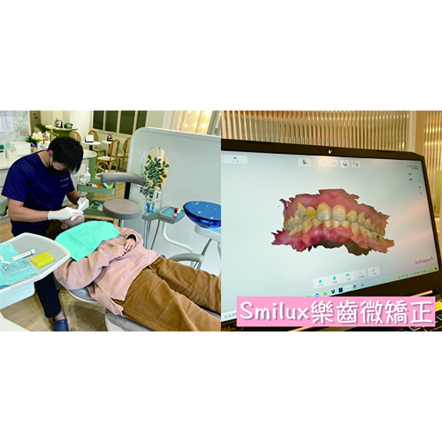 [樂齒 x 愛麗絲的吃不停人生]門牙矯正告別兔寶寶牙！隱形牙套的日常生活part2 ～SMILUX樂齒微矯正價格