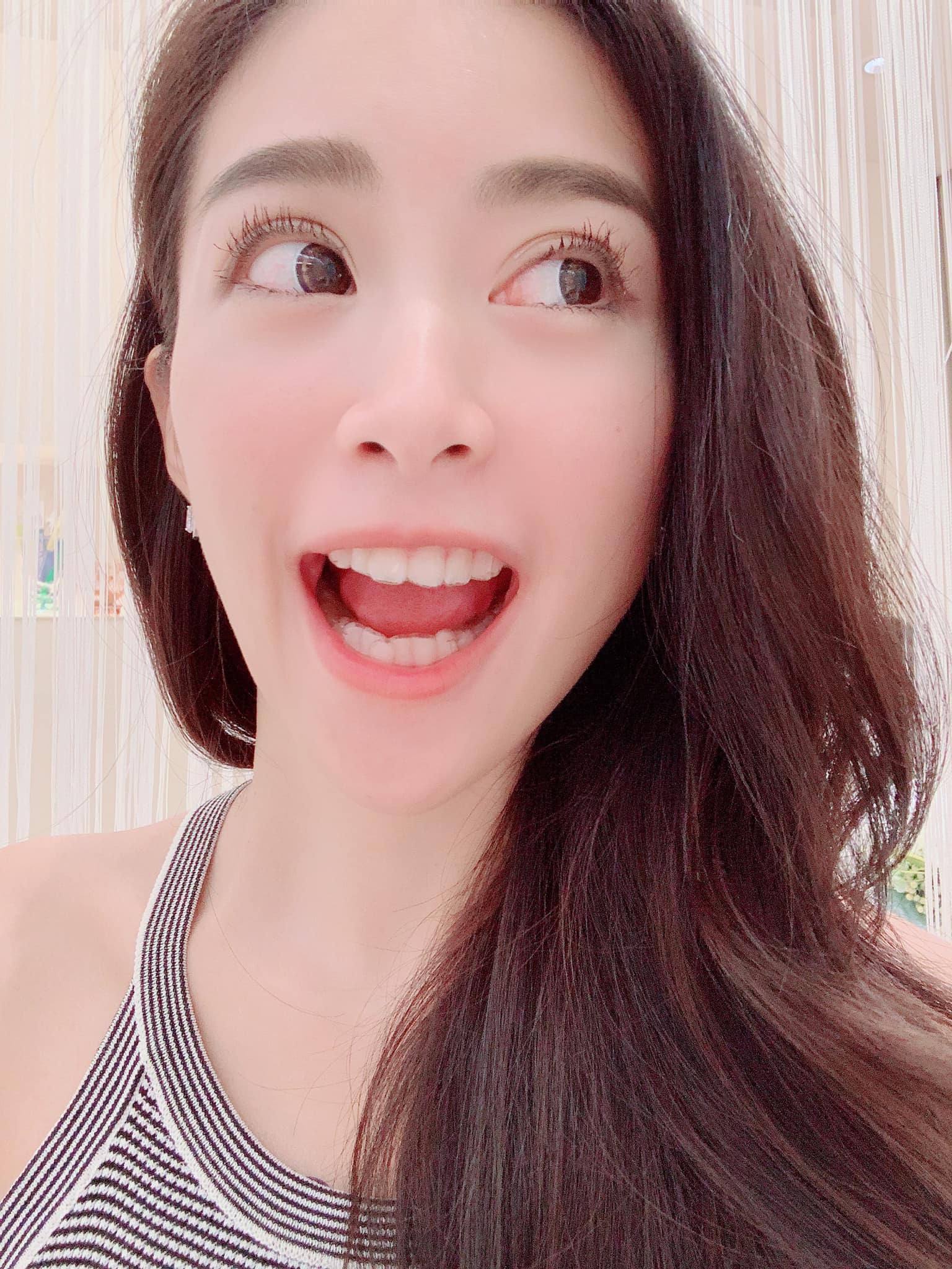 [專科 x 小青] 不愛戴維持器而走鐘，二次矯正10萬太太太難得了