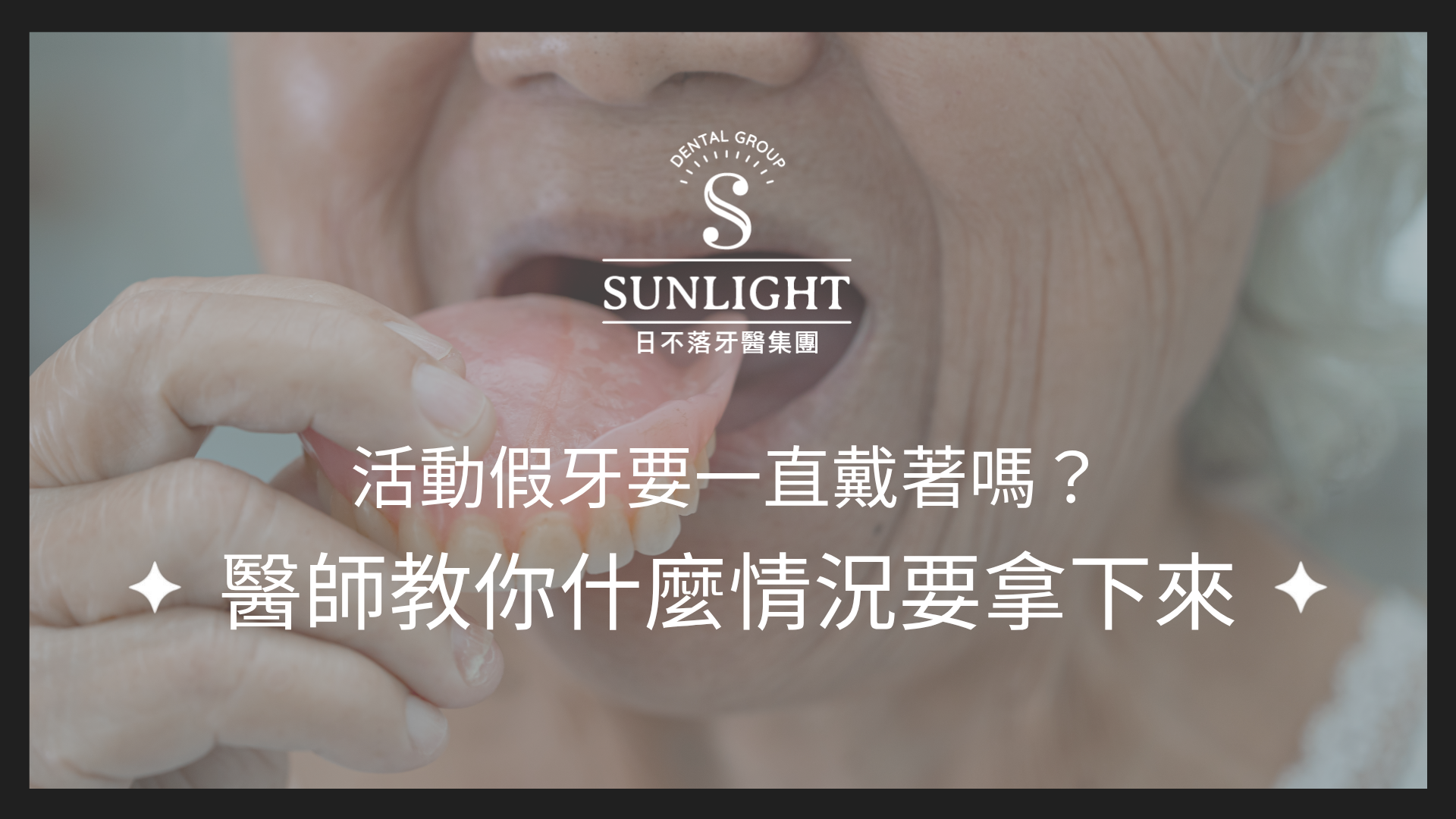 活動假牙要一直戴著嗎?醫師教你什麼情況要拿下來