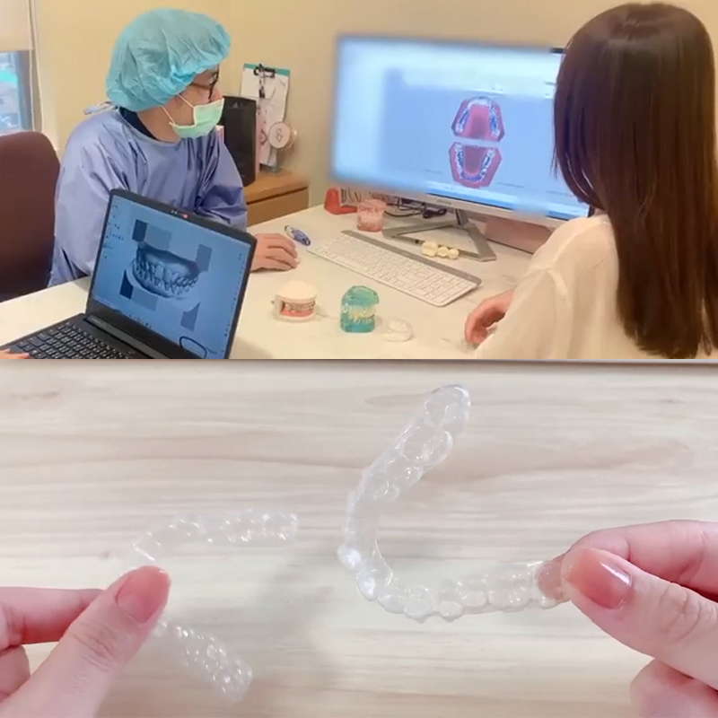 [SOV x 安安小日常]太期待了牙齒整齊後的樣子了！現在口中沒有牙套的時候，好沒安全感！