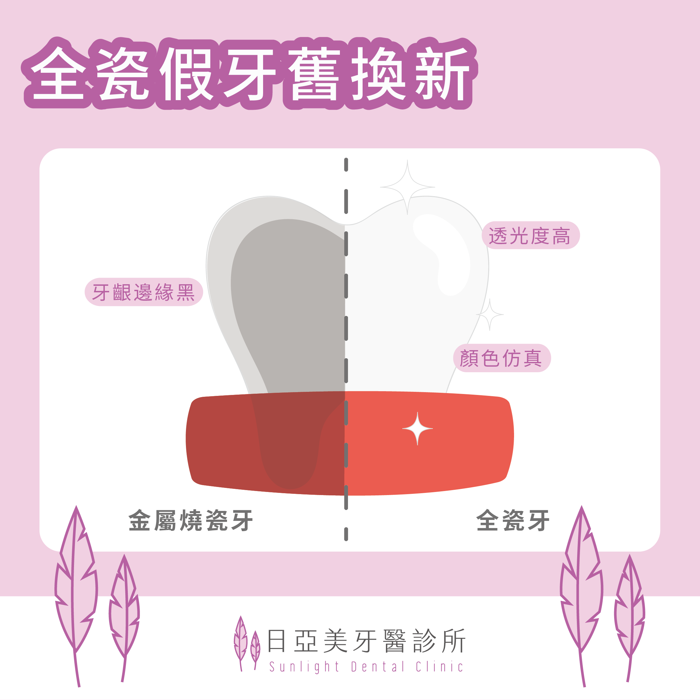 假牙周圍的牙齦為什麼黑黑的？！