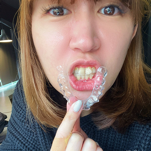[SOV x 美奈子的。微日本旅行]隱形矯正回診分享，發現可能提早結束!?