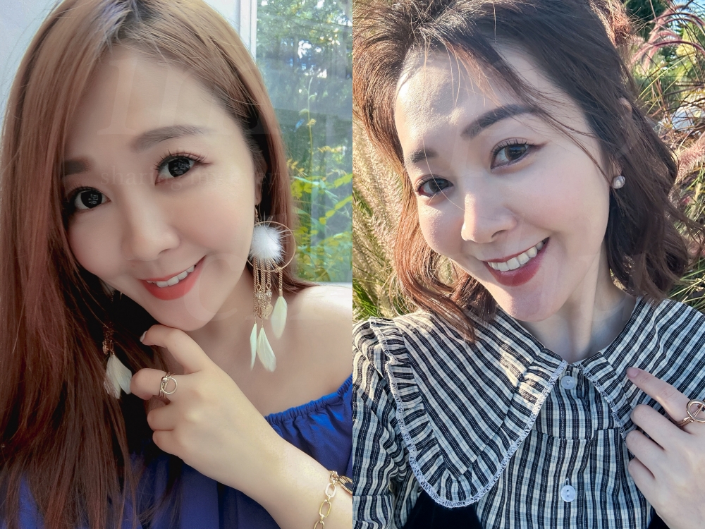 [SOV x 啾啾愛亂拍] SOV隱形牙套優缺點 / 虎牙矯正前後對比成果照