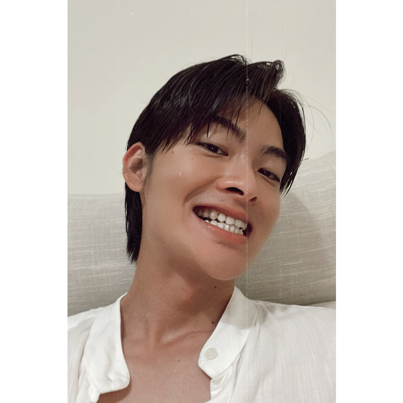 [SOV x王庭勻]因為配戴SOV隱形矯正牙齒變整齊了，整個人看起來都清爽了！
