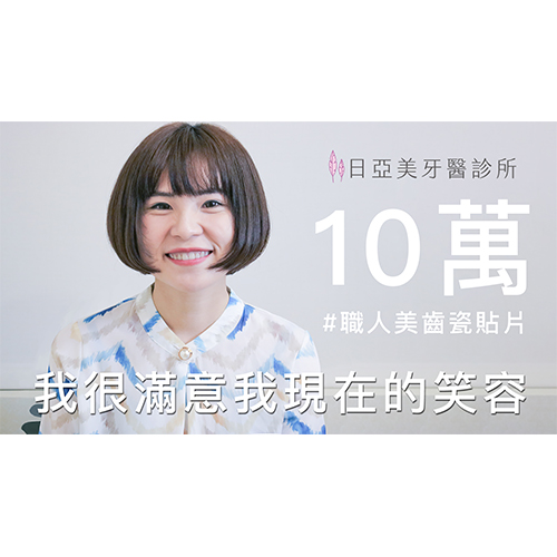 [職人瓷貼片]日亞美貼片價格親民，改造原本笑起來都需要遮遮掩掩的我🦷