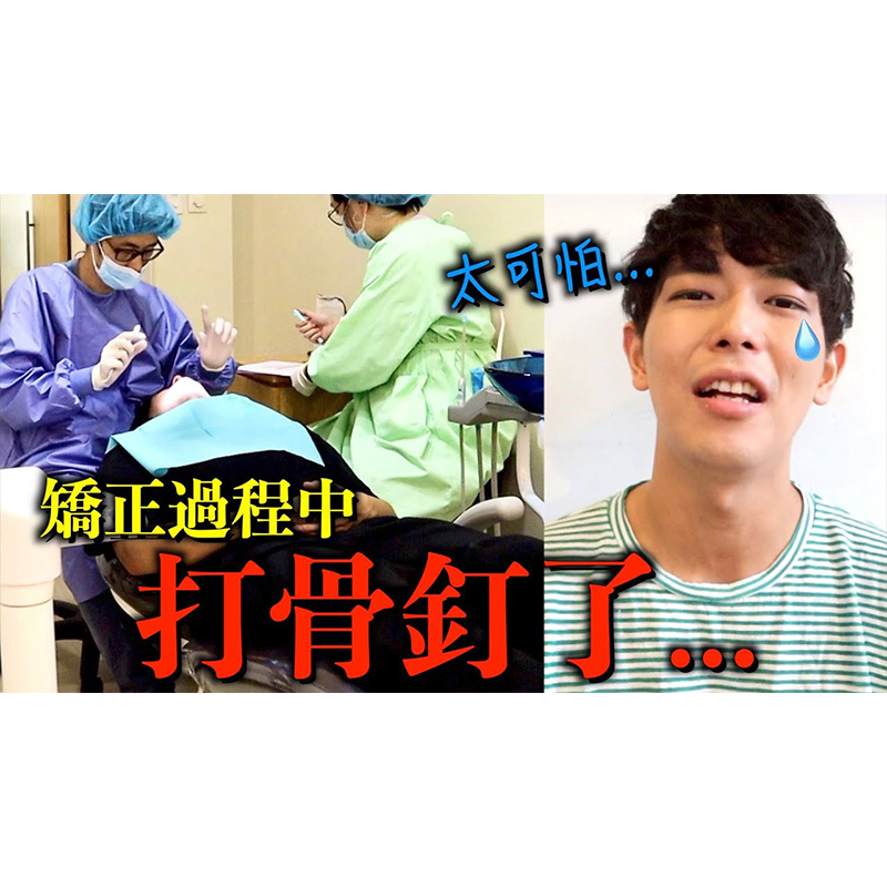 [樂齒 x 一樹] 戴牙套3個月有沒有變化?!人生上第一次打骨釘...痛嗎...??