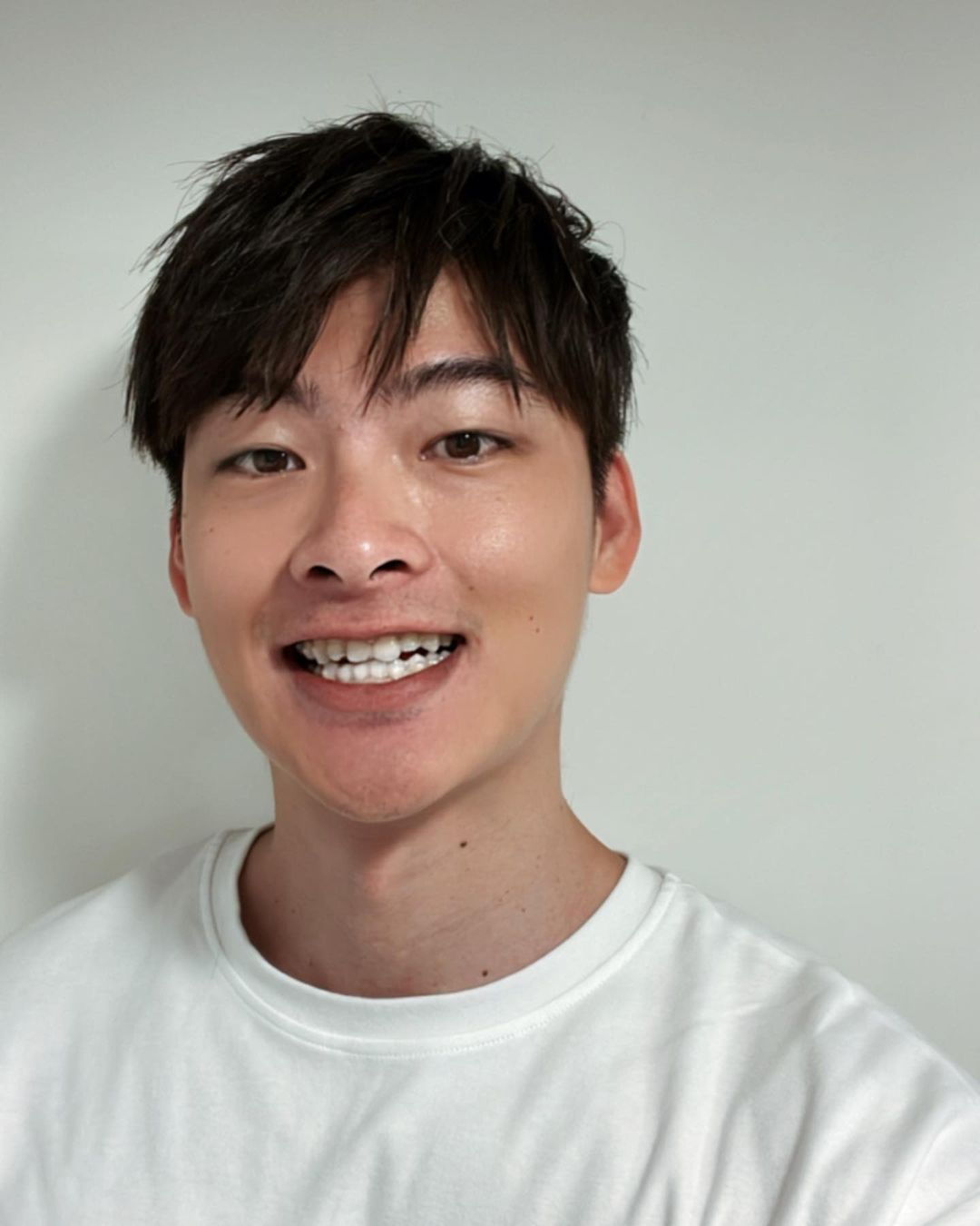 [SOV x 王庭勻] 長大了對外表也是會感到在意或沒自信，但看到整齊的牙齒還是有種開心的感覺，有需要可以去日亞美的劉醫師看診