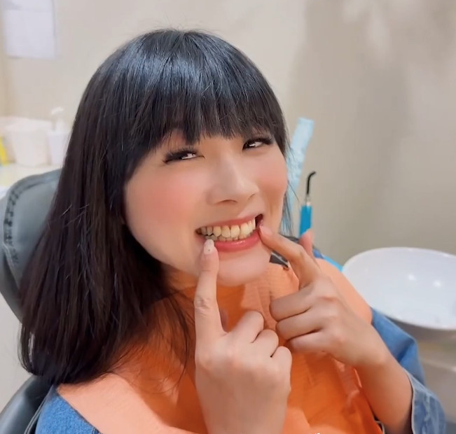 [樂齒 x 梅子] 大學時期時，就戴過一次傳統的牙套，因為沒好好戴維持器🥹 牙齒沒這麼整齊，後來我選擇到日亞美牙醫診所給童偉倫醫師專業評估～醫師專業又細心，牙齒很放心交給他