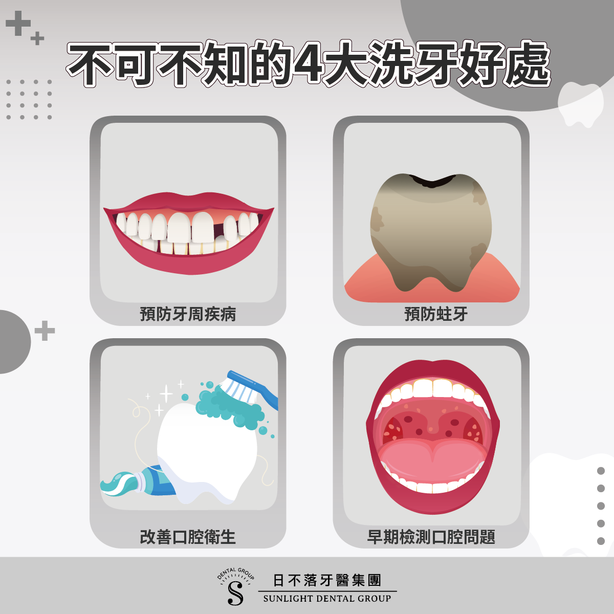 洗牙為什麼重要？洗牙多久一次正常呢？洗牙好處、頻率、常見問題、迷思一次解答！