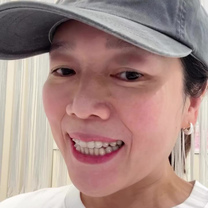 [樂齒 x 大羊] SOV隱形牙套：台灣製造，不限次數微調，告別二次矯正困擾！