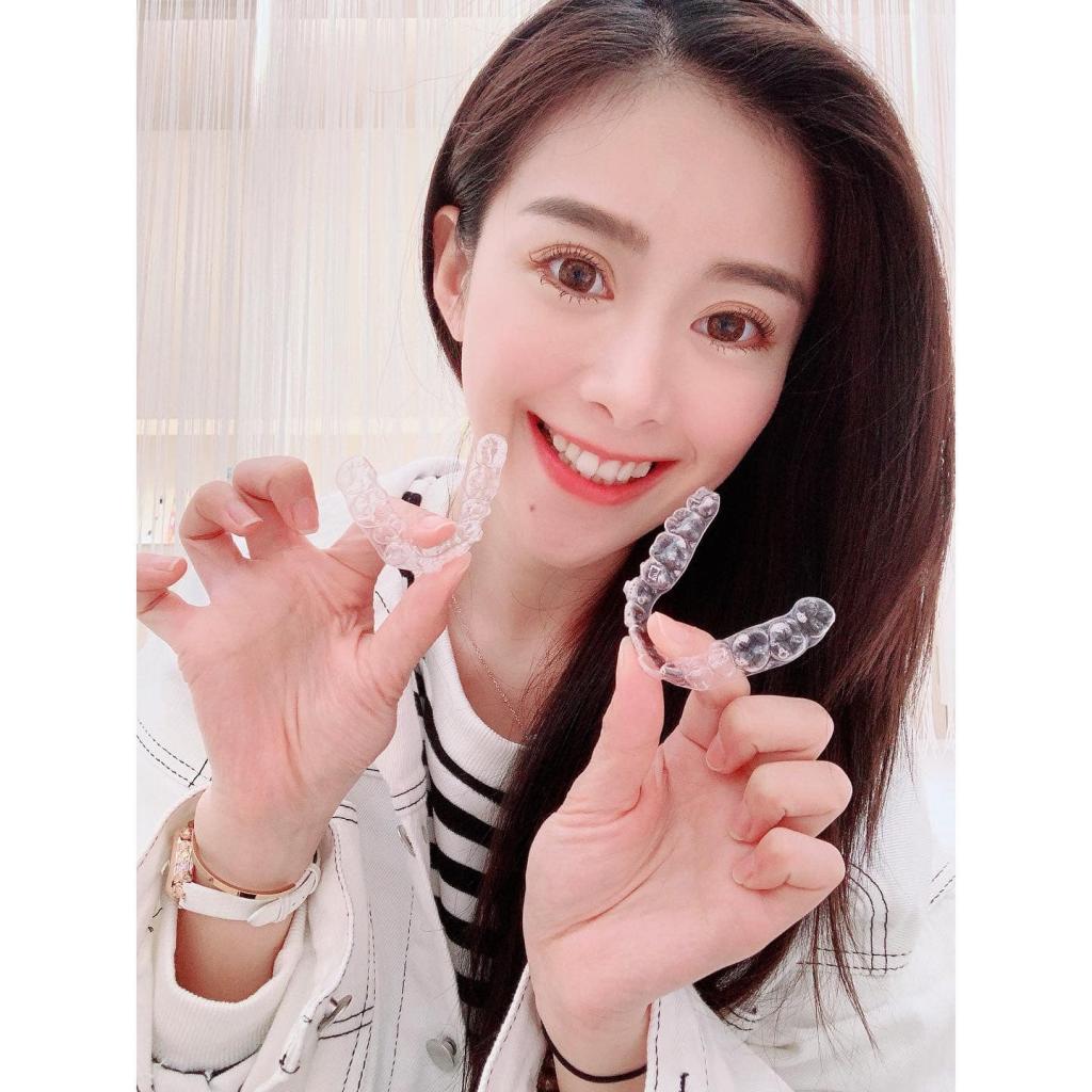 [專科 x 小青] 10萬隱形矯正，繼續我的完美牙齒計畫