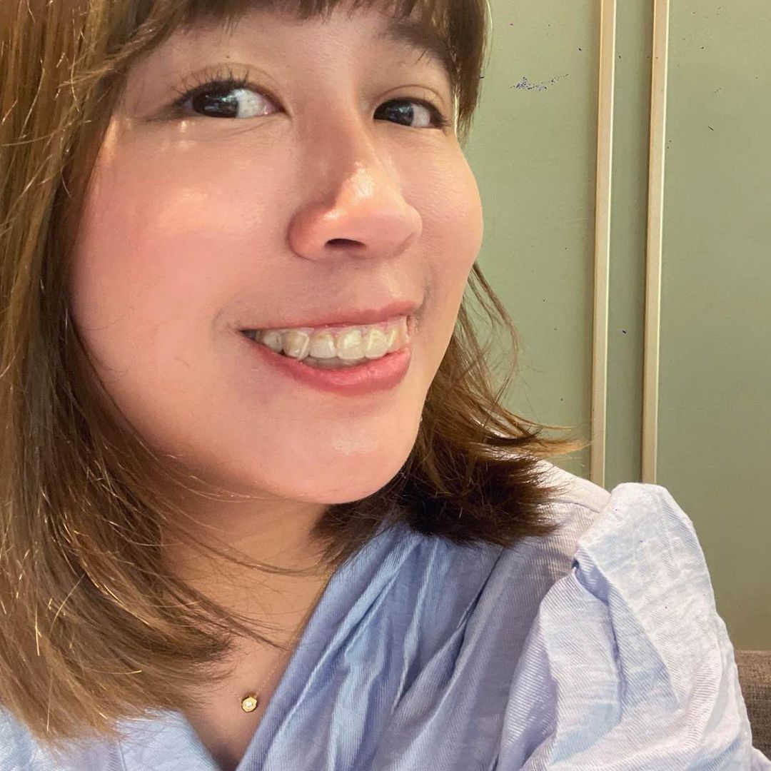 [SOV x 美奈子的微日本旅行] 上次微調之後見到很久不見的朋友，朋友説覺得我側面看起變瘦，但我覺得應該是牙齒矯正關係讓側面線條變好看