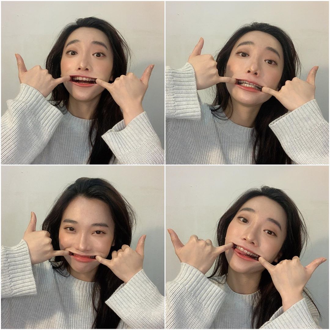 [SOV x 沈摯亞] 戴上SOV隱形矯正牙齒對齊了😍