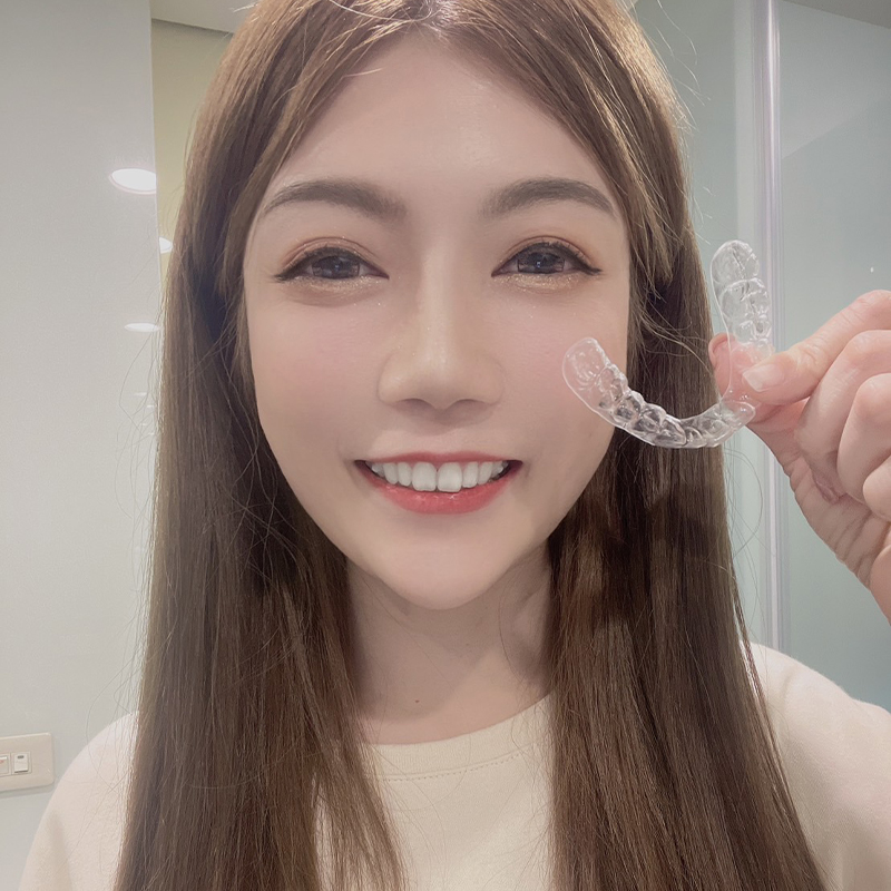 [樂齒 x 星岑Lavender] Smilux樂齒微矯正讓你方便拆方便戴，也完全不會有感覺到痛的程度！