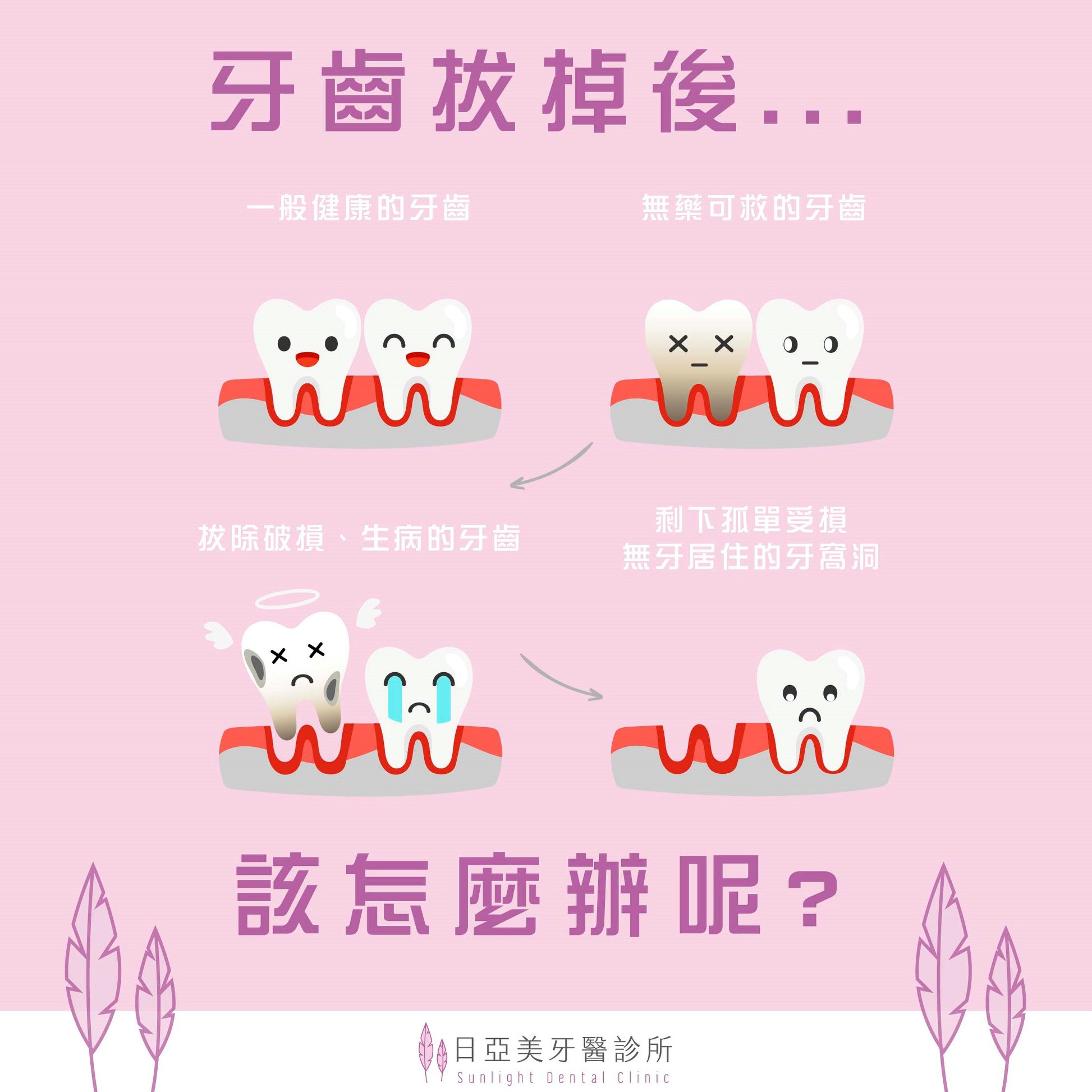 拔牙、拔智齒後的牙洞該如何快速消腫