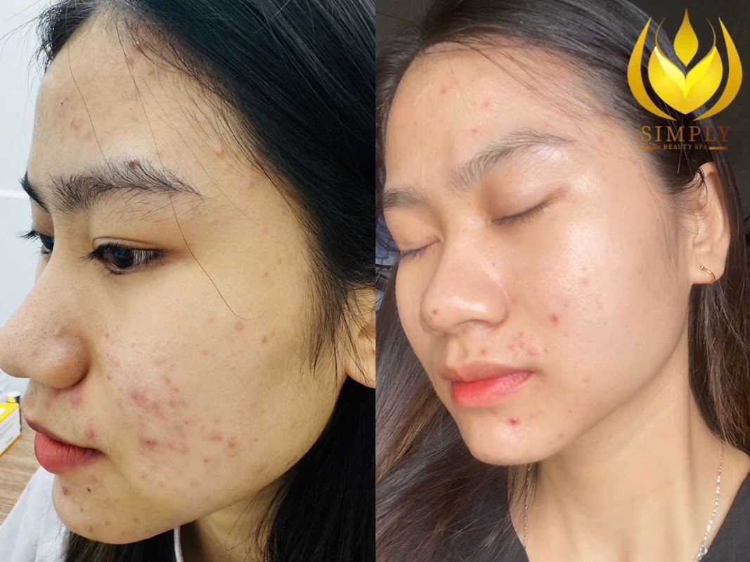 USbeauty Care Spa - chăm sóc da, chăm sóc tóc, tẩy tế bào chết chuẩn Mỹ – ảnh 4