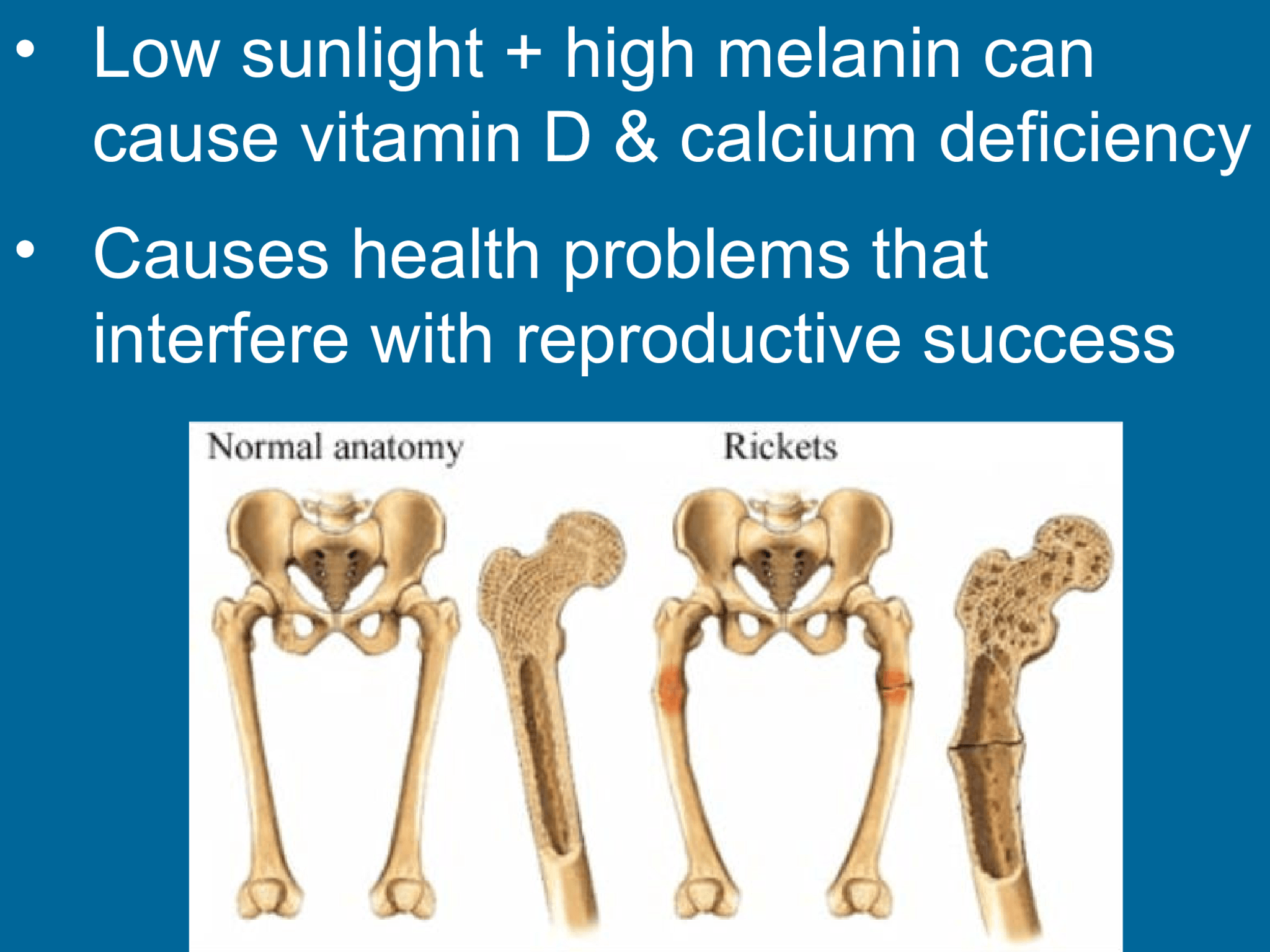 • Low sunlight + high melanin can  cause vitamin D & calcium deficiency • Causes health problems that  interfere with reproductive success