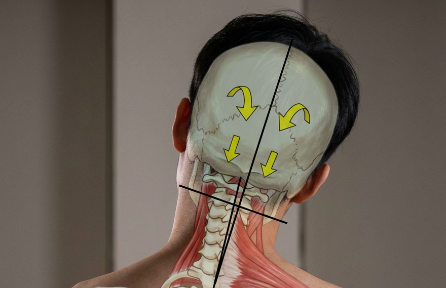 두개천골 & 경추 추나
