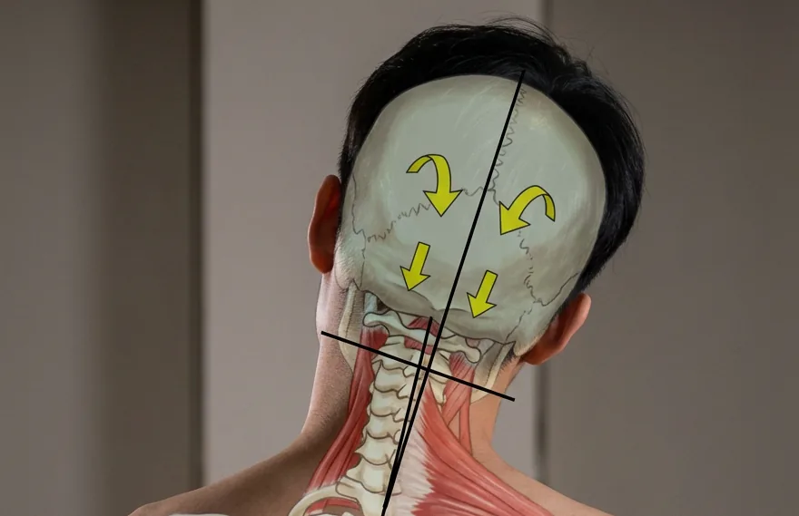 두개천골 & 경추 추나