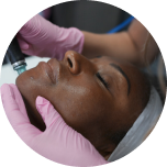 LaserAway service image for Hydrafacial®