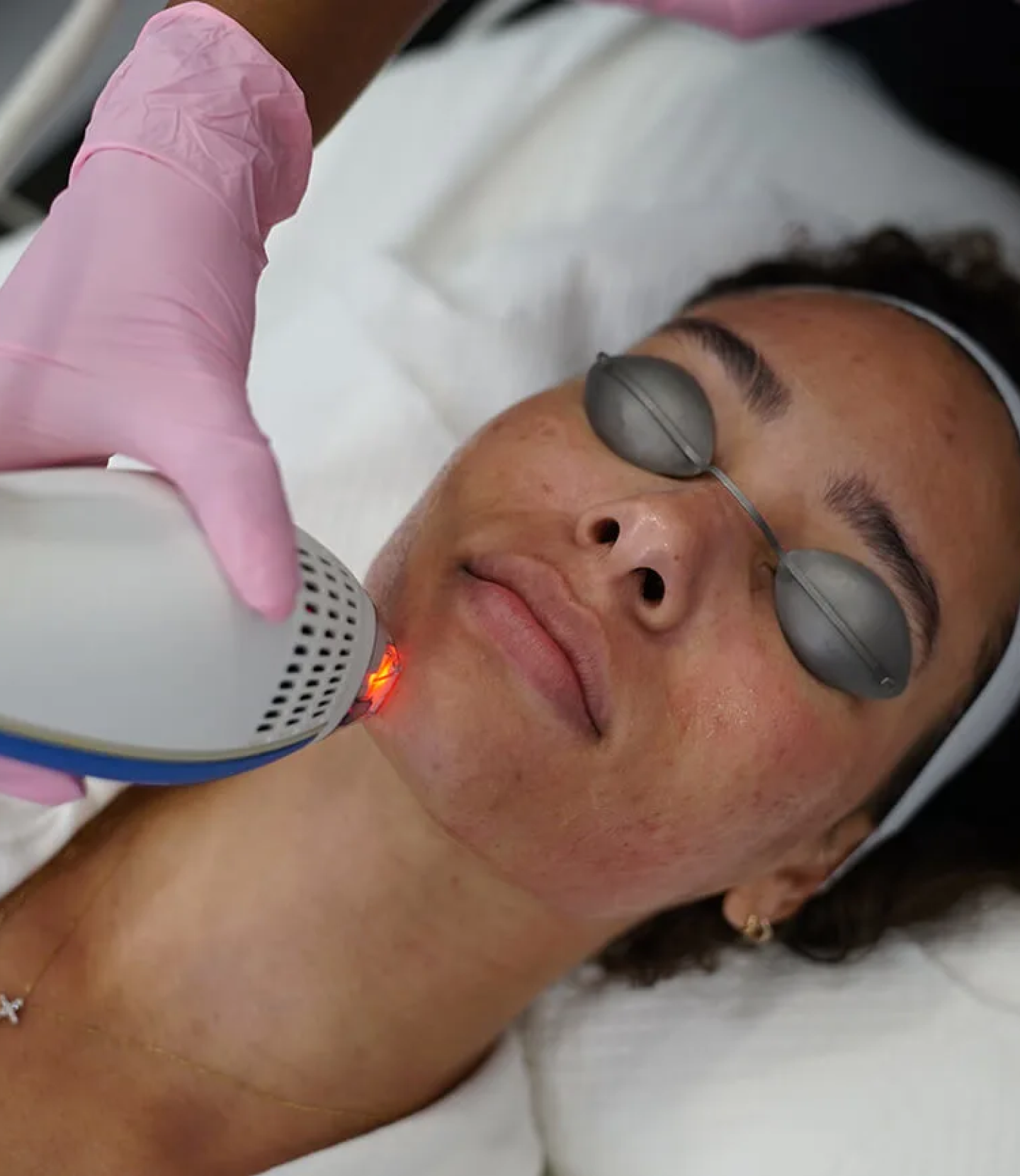 Clear + Brilliant® Laser Facial