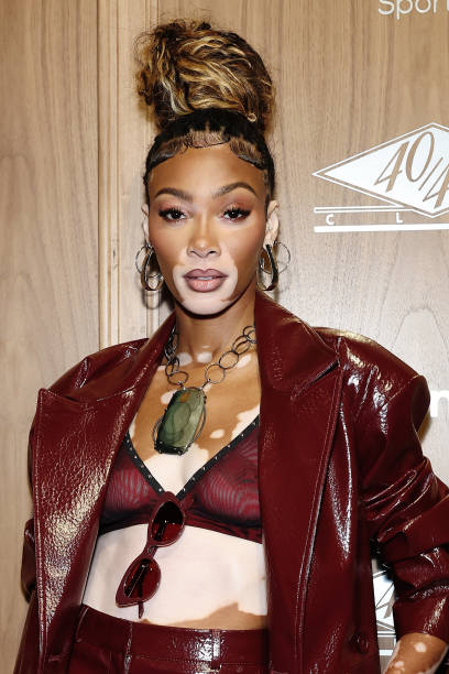 photo-Winnie Harlow 2024