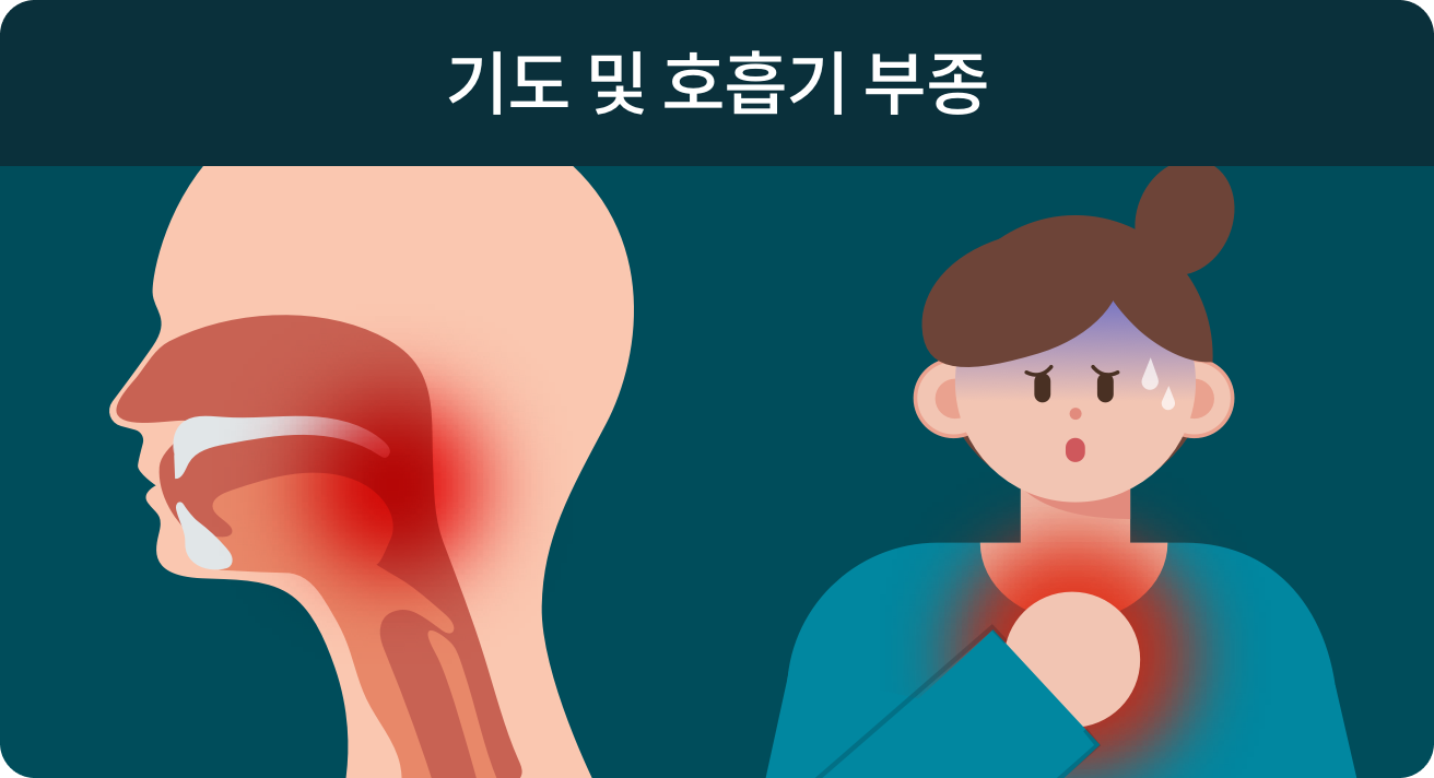 기도 및 호흡기 부종