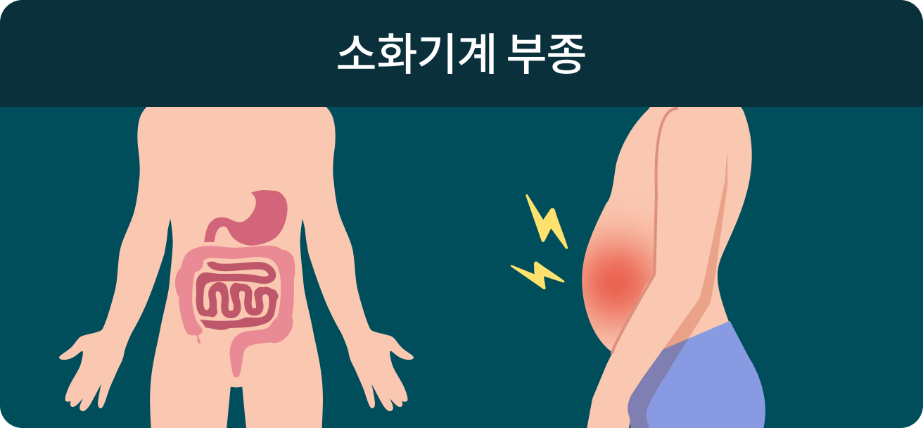 소화기계 부종