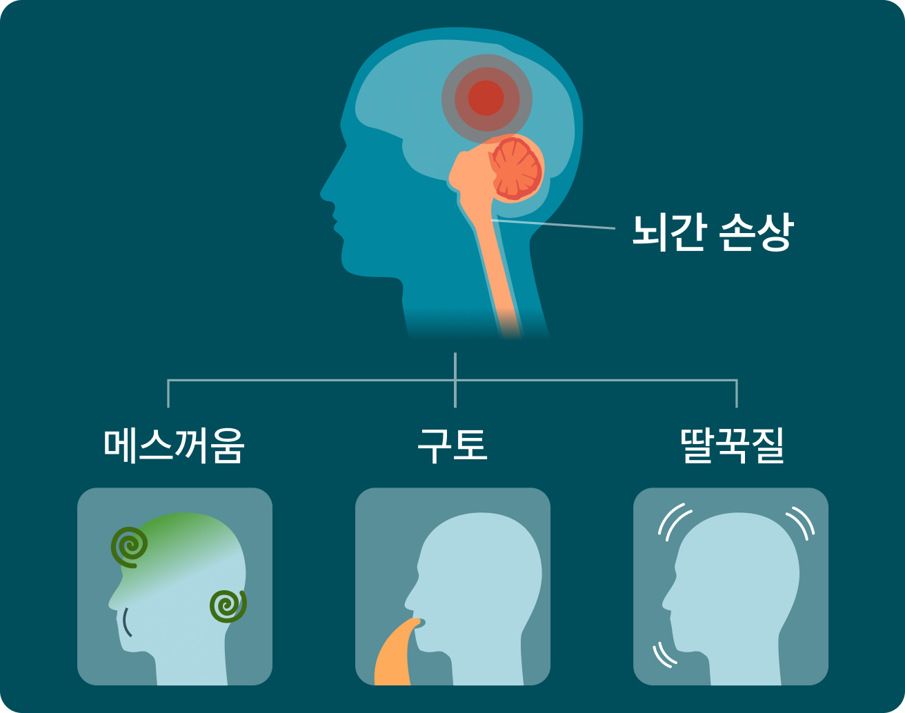 뇌간 손상, 메스꺼움, 구토, 딸꾹질