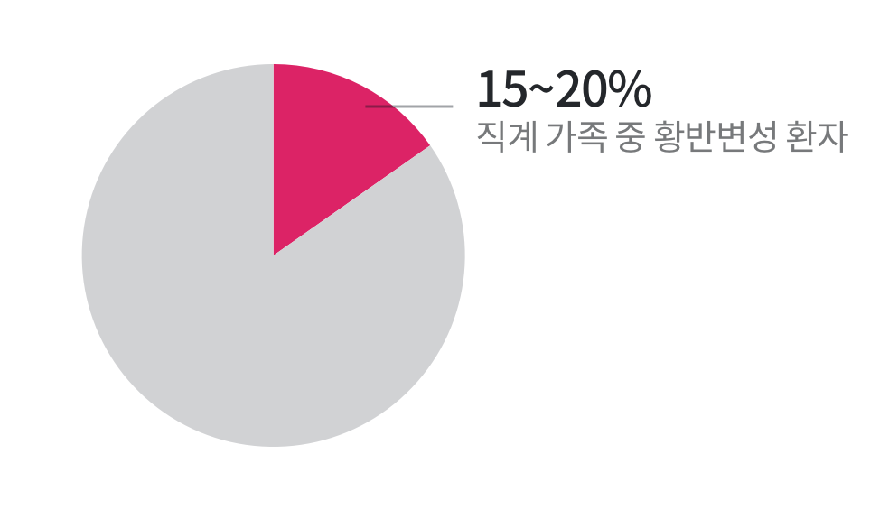 15~20% 직계 가족중 황반변성 환자