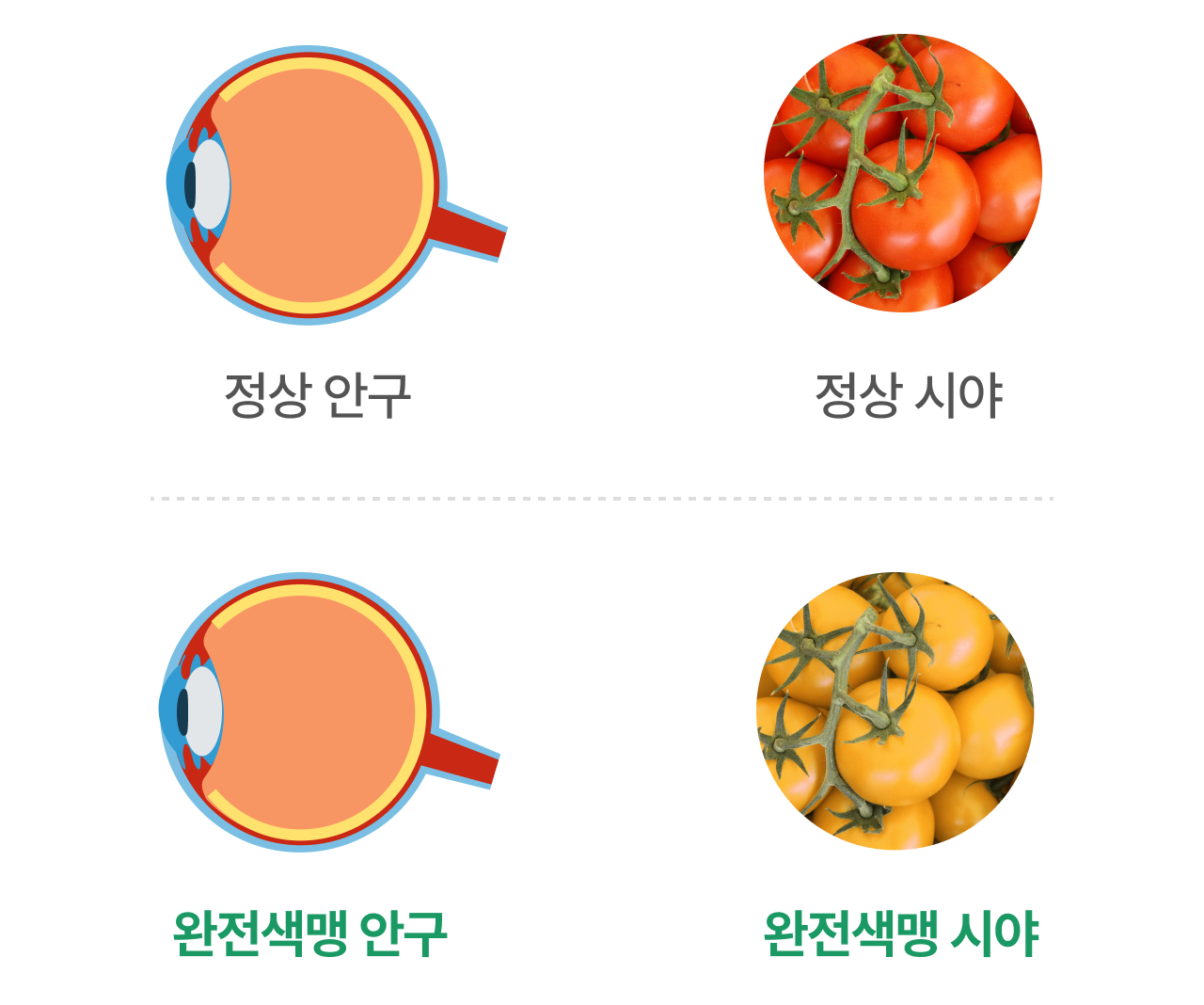 완전색맹 안구, 완전색맹 시야